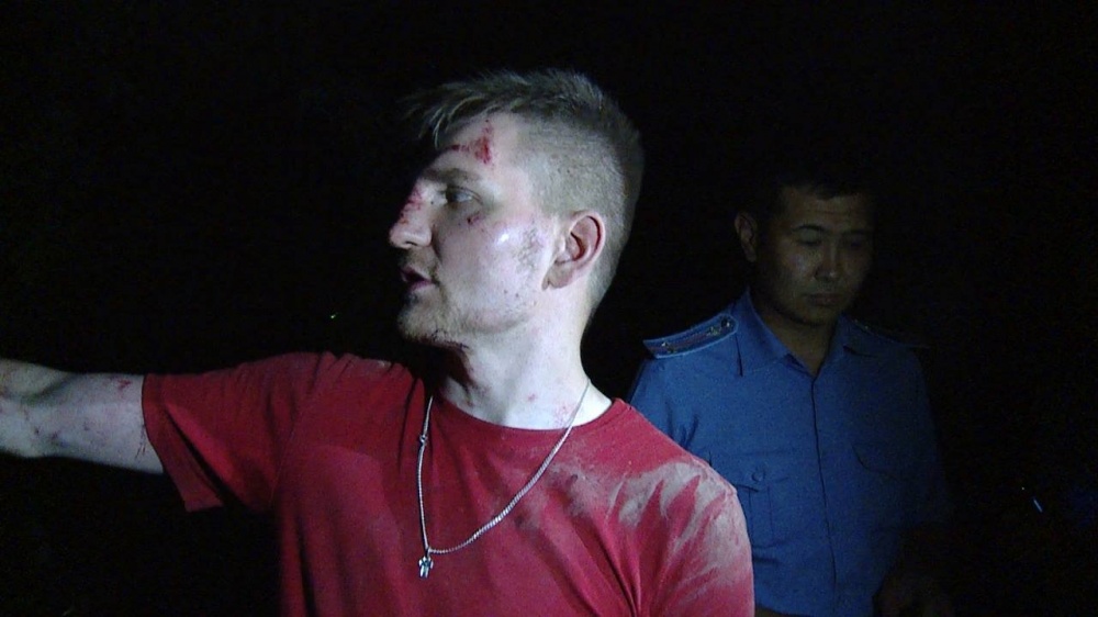 Милиционеры избили сотрудника телеканала "Пирамида" (фото)