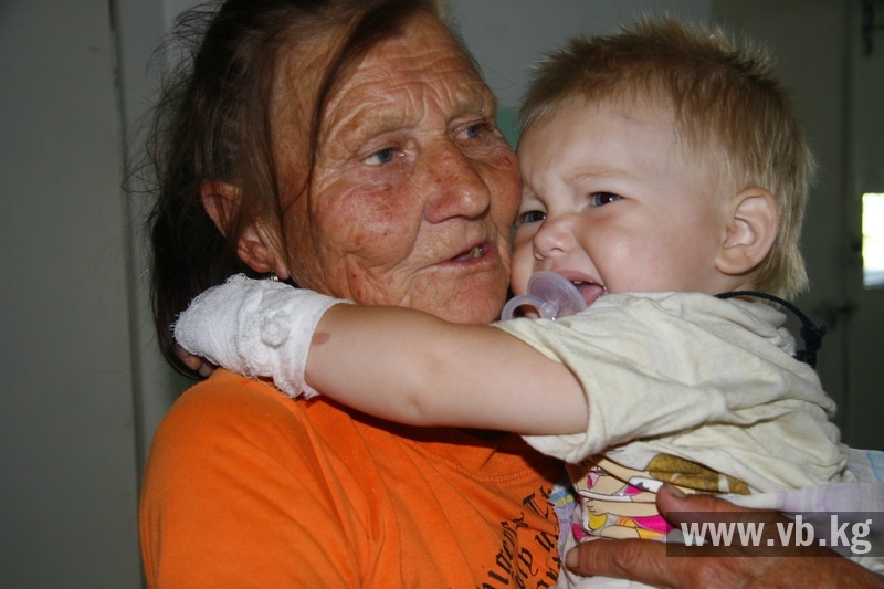Обожженной девочке срочно нужна помощь