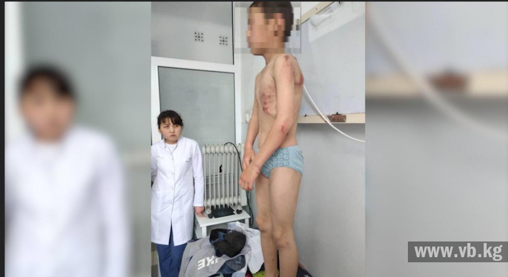 Родной дядя привязал мальчика к машине и протащил его по дороге