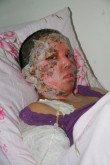 Азисе Шаакеримовой для проведения операции срочно требуется помощь