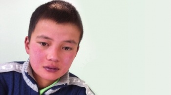 На операцию для мальчика из Нарына Калмырзы Асылбек уулу срочно требуются деньги