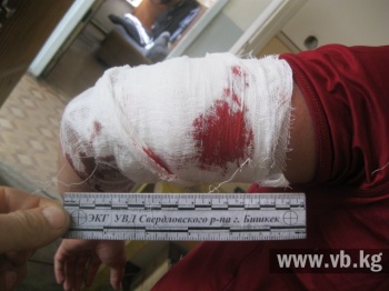 ГУВД: Во время вчерашнего задержания оперативник получил ранение