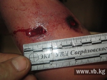 ГУВД: Во время вчерашнего задержания оперативник получил ранение