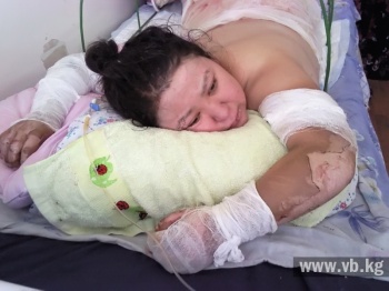 Обожженным людям срочно нужна помощь