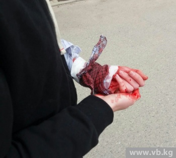 В Бишкеке прохожая девушка и сотрудник МЧС спасли девочку от кровопотери