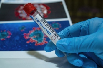 В Кыргызстане за сутки выявлено еще 35 новых зараженных COVID-19