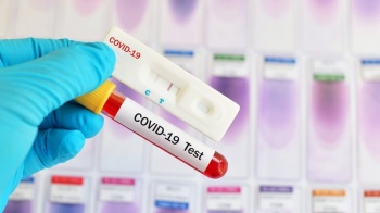 В Кыргызстане выявлено еще 60 новых случаев COVID-19