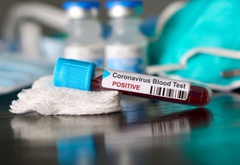 В Кыргызстане выявлено еще 87 новых случаев COVID-19. Большинство в Бишкеке
