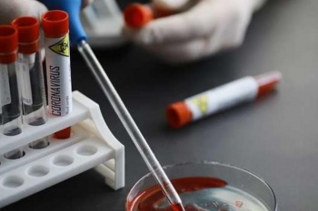 На 5 июля 283 новых случаев COVID-19