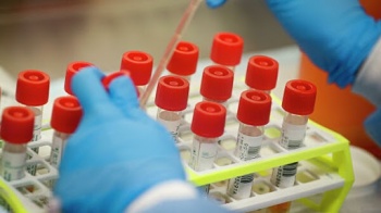 Чиновников Казахстана заподозрили в манипуляции статистикой по COVID-19