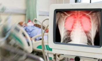 Евроньюс: Ситуация с COVID-19 в Кыргызстане развивается по худшему сценарию