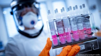 В Узбекистане наладили собственное производство тест-систем на COVID-19