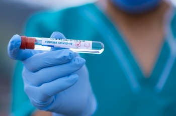 Статистика по COVID-19 на 22 сентября в Кыргызстане