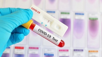 В Кыргызстане за сутки от Covid-19 умерло трое человек
