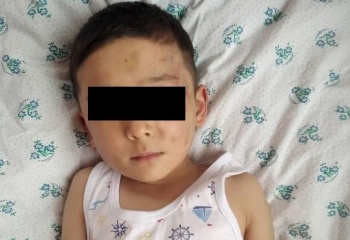 Жестокое избиение 6-летнего ребенка. Отчим мальчика задержан