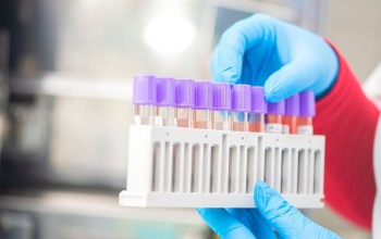 Помимо частных, 2 гослаборатории будут делать тесты на COVID-19