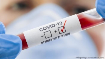 В Кыргызстане за сутки выявлено 76 новых случаев COVID-19