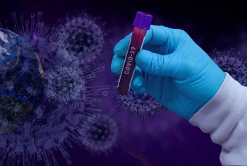 В Кыргызстане на 7 апреля зарегистрирован 161 новый случай COVID-19