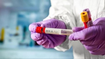 В Кыргызстане за сутки выявлено 333 новых случаев Covid-19