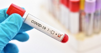 В Кыргызстане на 1 июля зарегистрировано 1392 новых случая COVID-19