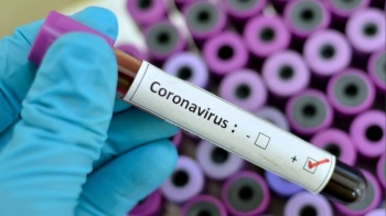 В Кыргызстане на 20 июля - 1291 новый случай COVID-19