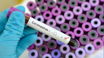 В Кыргызстане на 4 августа зарегистрировали 696 новых случаев COVID-19