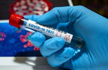 В Кыргызстане на 7 августа зарегистрировали 681 новый случай COVID-19