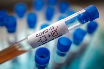 В Кыргызстане за сутки 97 новых случаев COVID-19, скончались – 4 человека