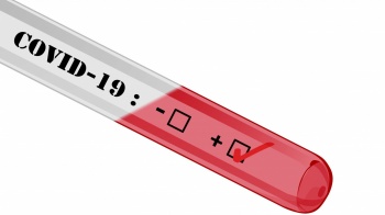 В Кыргызстане за сутки 107 новых случаев COVID-19, скончались – 2 человека