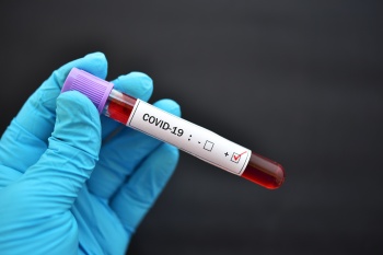 В Кыргызстане на 30 ноября зарегистрировано 66 новых случаев COVID-19