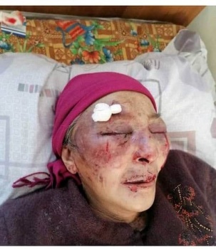 Жительницу Баткена жестоко избили за "наведение порчи"