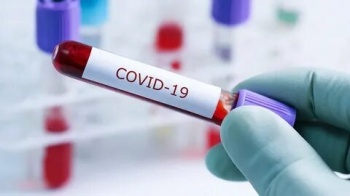 В Кыргызстане на 19 января зарегистрировано 870 новых случаев COVID-19