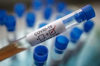 В Кыргызстане на 26 января зарегистрировано 370 новых случаев COVID-19