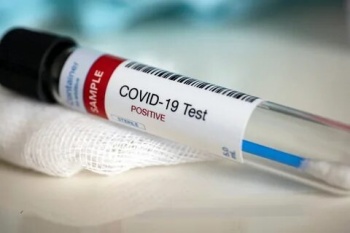 В Кыргызстане на 29 января зарегистрировано 356 новых случаев COVID-19
