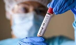 На 8 февраля в Кыргызстане зарегистрировано 98 новых случаев COVID-19