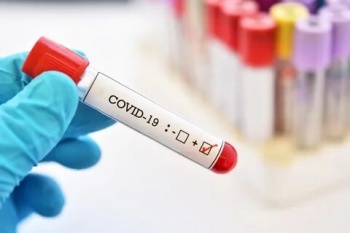 В Кыргызстане на 16 февраля зарегистрировано 54 новых случая COVID-19