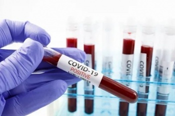 В Кыргызстане на 22 февраля зарегистрирован 31 новый случай COVID-19