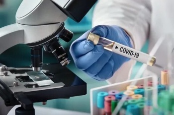 В Кыргызстане на 25 февраля зарегистрировано 25 новых случаев COVID-19
