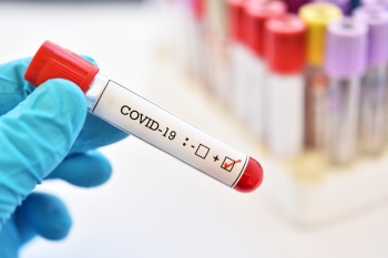 В Кыргызстане на 7 марта зарегистрировано 10 новых случаев COVID-19