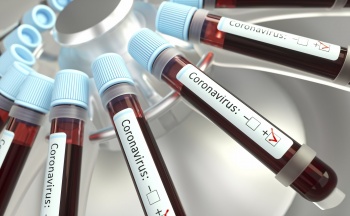 В Кыргызстане на 11 марта зарегистрировано 16 новых случаев COVID-19
