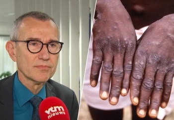 Бельгия первой в мире ввела карантин для заболевших обезьяньей оспой