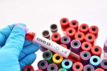 В Кыргызстане за сутки зарегистрировано уже 47 новых случаев COVID-19