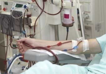 В Кыргызстане увеличивается количество больных, нуждающихся в гемодиализе
