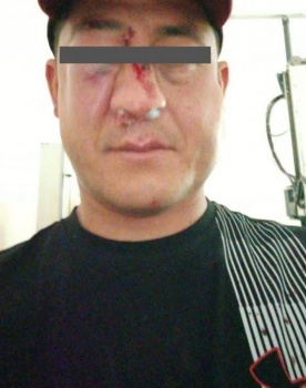 Судья Ленинского района отпустил парня, жестоко избившего капитана милиции