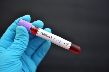 Названы психологические последствия COVID-19