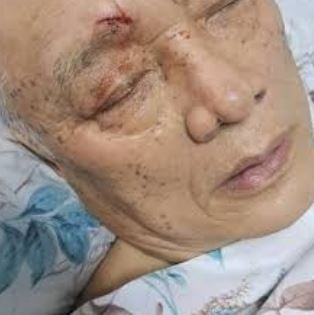 Инсценировка обморока и синяки: экс-депутат Айжигитов снова устроил шоу